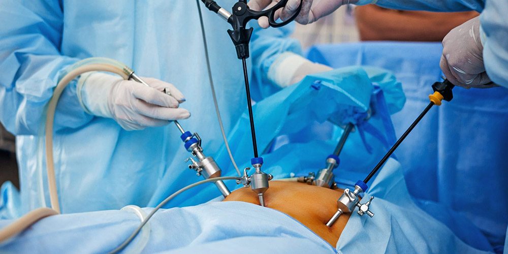 Cirurgião Marcelo Heidrich explica colecistectomia, retirada da vesícula biliar